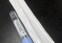The Case Law Behind DNA Tests DNA swab kit