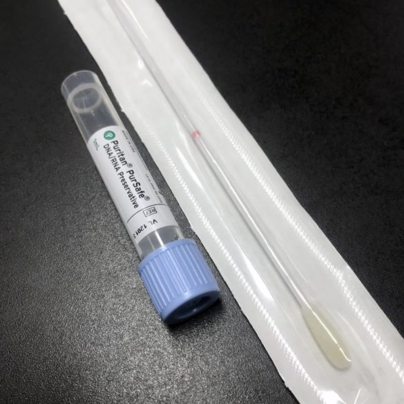 DNA swab kit