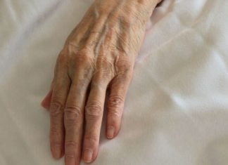 Grand Junction Caregivers Charged by AG’s Office in Death of 86-Year-Old Woman A wrinkled hand rests on cream colored bedsheets.