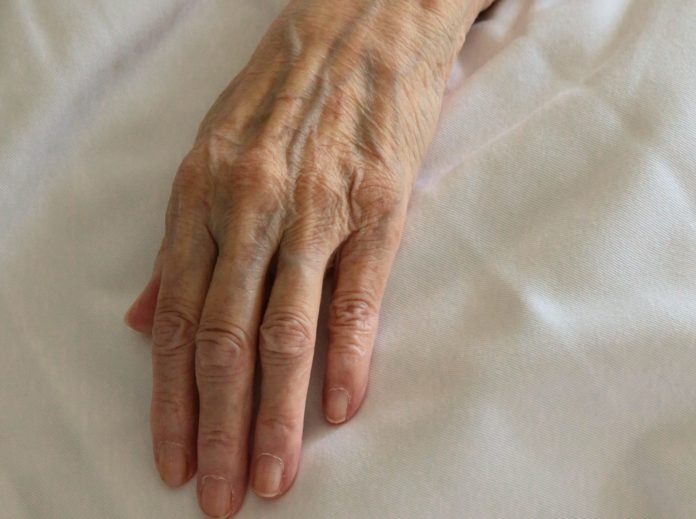A wrinkled hand rests on cream colored bedsheets.