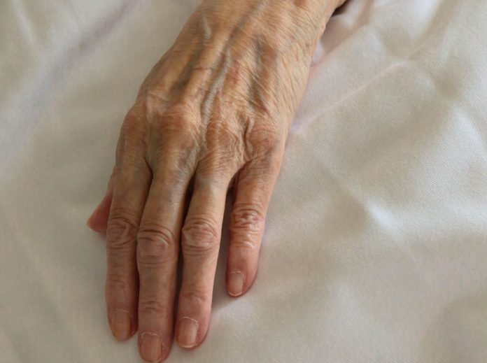 Grand Junction Caregivers Charged by AG’s Office in Death of 86-Year-Old Woman A wrinkled hand rests on cream colored bedsheets.