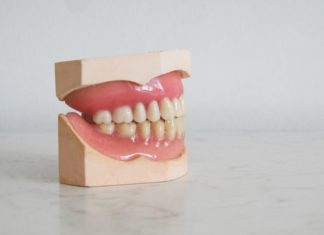 Drilling Down on Dental Malpractice Law A pair of fake teeth with a gum line rest on a counter.