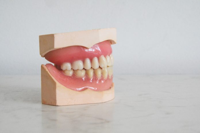 A pair of fake teeth with a gum line rest on a counter.